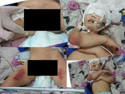 Дөрвөн настай охин төрсөн эцэг, хойд эхийн харгис хүчирхийллийн улмаас амиа алджээ