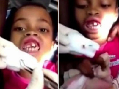 10-тай охины буйлаас 15 амьд өт гаргаж авчээ VIDEO