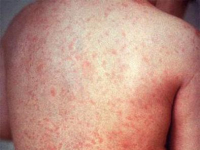 Улаан бурхан дахин дэгджээ