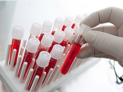 Зарим иргэнийг эмнэлгийн байгууллагад хандахыг зөвлөлөө