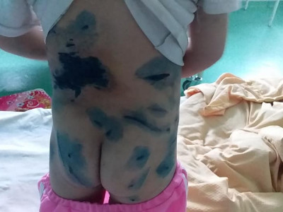 Нохойд бариулсан хоёр настай охины гэр бүлд 100 мянган төгрөг өгье гэжээ