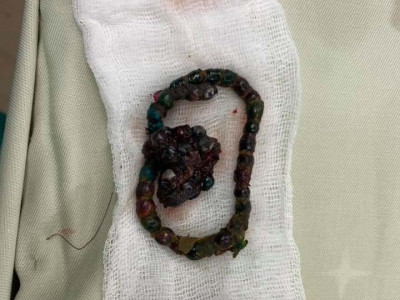 Дөрвөн настай хүүд мэc заcал хийж, xoдоодноос нь 56 ширхэг coронз авчээ