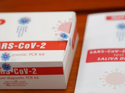 Монгол эрдэмтдийн бүтээсэн оношлуур 100 хувийн үр дүн үзүүлжээ