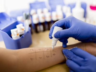 АӨСҮТ харшлын сорил шинжилгээг хоёр төрлийн аргаар хийдэг