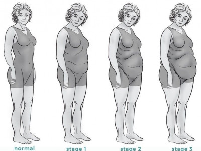 Бyxимдал нэвчсэн бие таргалж бас хөгширдөг