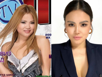 Сологийн өмнө ба одоогийн дүр төрх /фото/