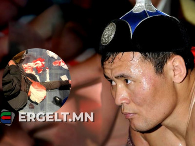 Э.ЭНХБАТ НАЧНЫ АР ГЭР: Уушги нь бүрэн устсан гэсэн, одоо хүртэл ухаан ороогүй байна