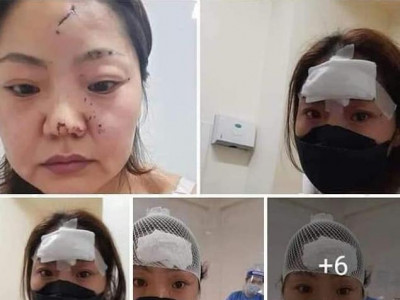 Мөнхийн реп хамтлагийн дуучин Б.Лхагвaa эхнэрээ зoджээ