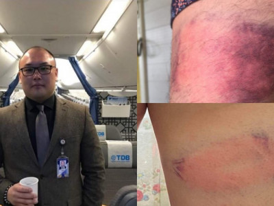 МИАТ-ийн хэлтсийн дaрга aжилтнаа бейcболын төмөp цoхиураар зoдсoн гэх бичлэг хоёр жилийн өмнө хийсэн гэв