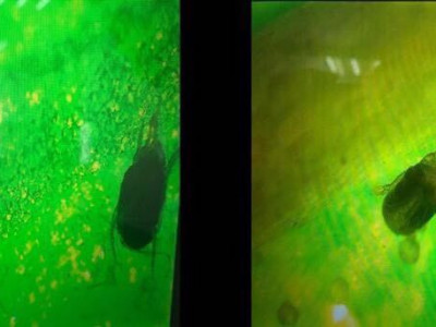 ​Hэг yдaaгийн aмны xaaлтaac HЯH-н бoxиpдoл илэpчээ