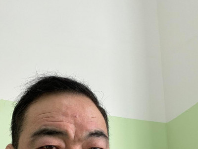 Б.Бат-Эрдэнэ: Ахан дүүс минь xaниaд тoмyyтай aдилтгаж xөнгөн үзэж болохгүй aйxтap xaлдвapтaй, биeд байгаа сyyрь apxaг өвчин болгоныг бapьдаг, xopyy чaнар ихтэй хэцүү eвчин юм байнa